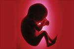 تحقیق-بررسی-احکام-سقط-جنین-یا-سقط-حمل